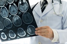 brain_mri_iStock-862563174