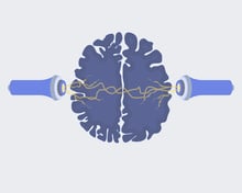 ect_brain_iStock-1492635261_edited